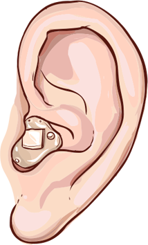 Sharpe Hearing inside the ear Ear Piece